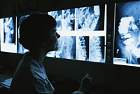 Picture of a physician viewing barium enema x-ray films