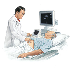 Duplex ultrasound can be used to view blood vessels in different areas of the body, such as the abdomen. Man lying on exam table. Health care provider is holding ultrasound probe to man's abdomen.