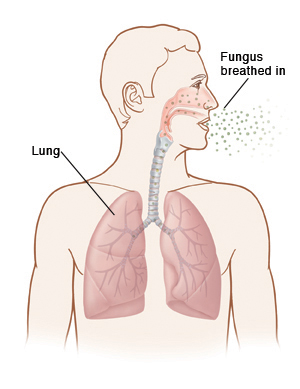 Outline of human head and chest with head turned to side. Inside of nose, trachea, and lungs are visible. Fungus is being breathed in to nose and lungs.