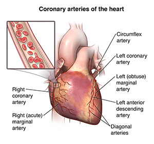 Illustration showing the outside of the heart and the coronary arteries