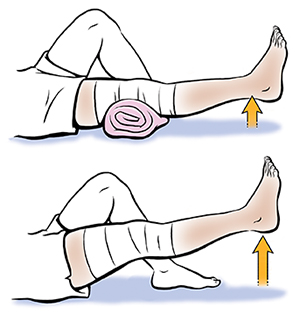 1. Leg from knee down showing short-arc knee extensions. 2. Leg from knee down showing straight leg raise.