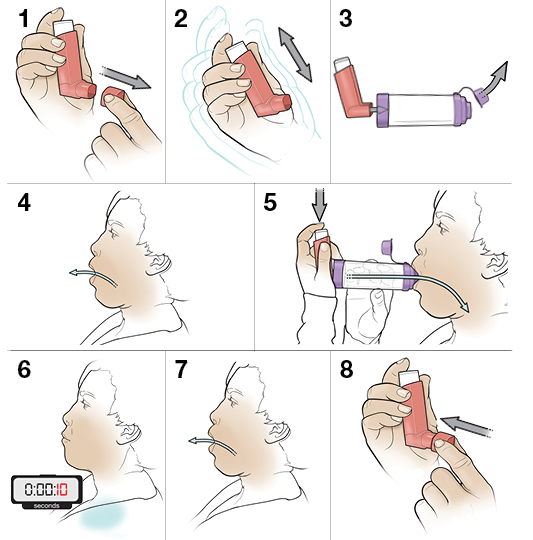 StepbyStep Using an Inhaler with a Spacer