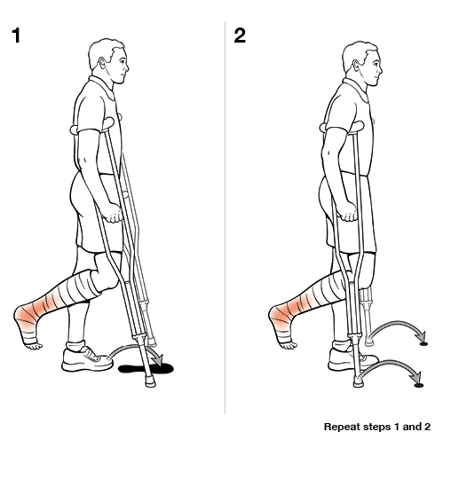 StepbyStep Using Crutches with Swing To (NonWeight Bearing)