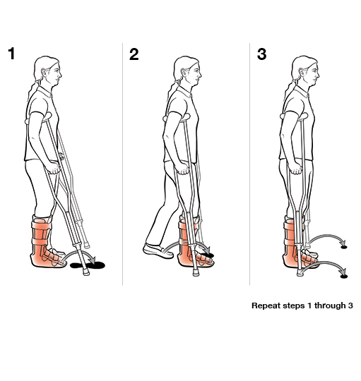 StepbyStep Using Crutches with Step To (Weight Bearing)