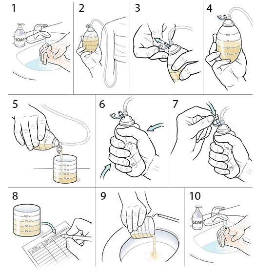 StepbyStep How to Empty Your Drain After Surgery