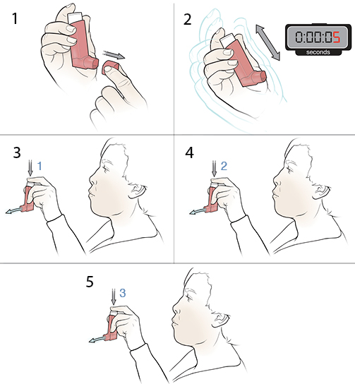 StepbyStep Priming Your Inhaler