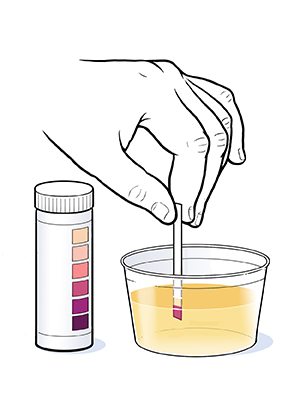 Discharge Instructions: Checking for Ketones
