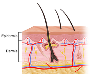 Cross section of skin showing dermis and epidermis.