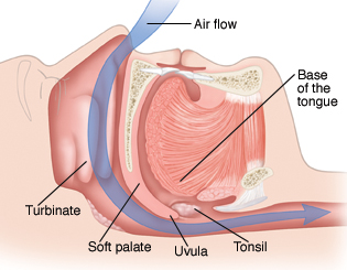 Side view image of the nose and mouth showing air flow through the nose, turbinates, soft palate, uvula, tonsil, and base of the tongue.