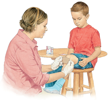 Wear gloves when there’s a chance of touching the blood of someone infected with hepatitis. Woman wearing gloves placing bandage on boy's injured knee.