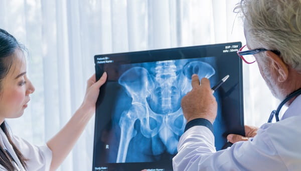 Two doctors are reviewing a patient's X-ray.