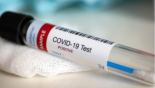 COVID-19 medical test tube