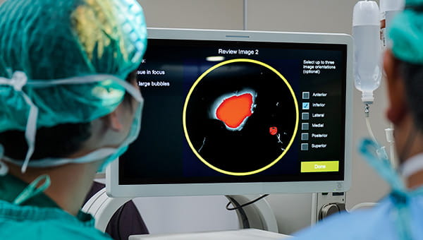 LumiSystemâ„¢, a cutting-edge surgical technology designed to detect residual breast cancer during the initial lumpectomy