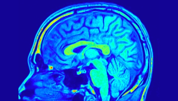 A blue brain scan with parts of the brain highlighted in other colors