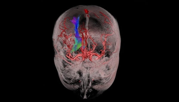 Brain Image for VR
