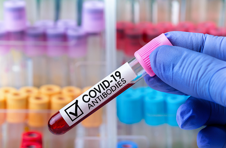 Test tube labeled covid 19 antibodies