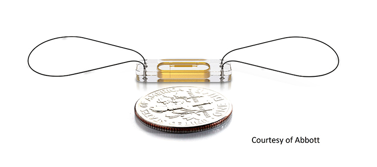 The CardioMEMS sensor is about the size of a coin or paper clip