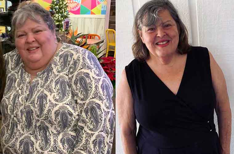 BayCare Patient Says ‘Life Couldn’t Be Better’ After Weight-Loss Surgery