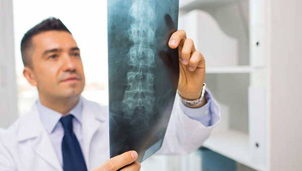 A male doctor is looking at an X-ray of a patient's spine.